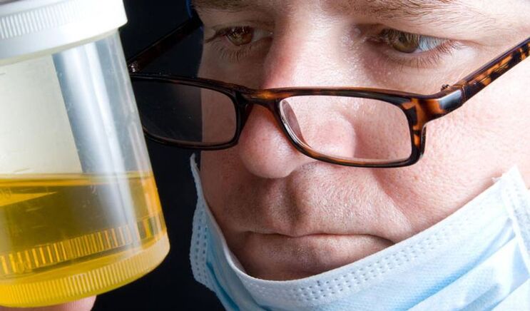 analýza moču na chronickú prostatitídu