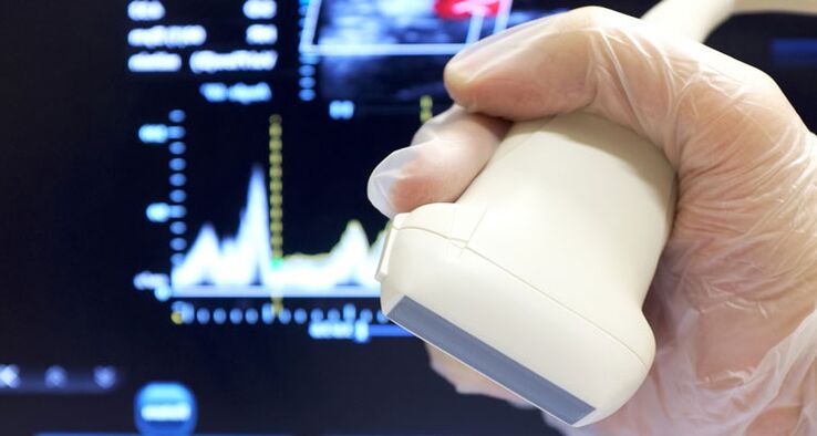 ultrazvuková diagnostika chronickej prostatitídy